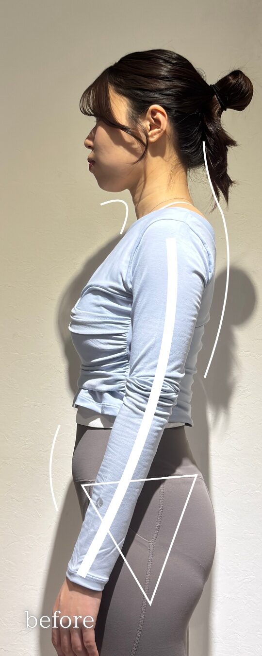 肩こりと猫背に悩んでいた30代デスクワーカーのビフォー